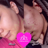اصل کرم چندکاره ایتالیایی
